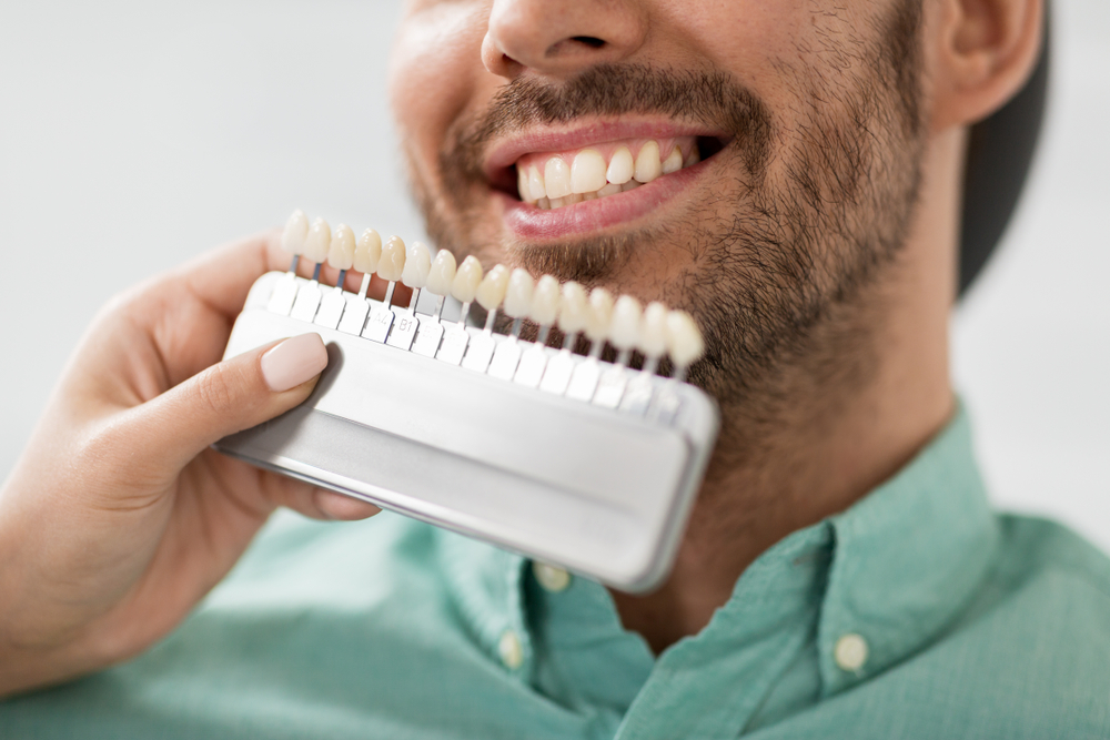 What Are Dental Veneers? Cost, Types, and Process