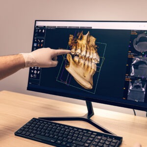 3-D xray program for dental implants