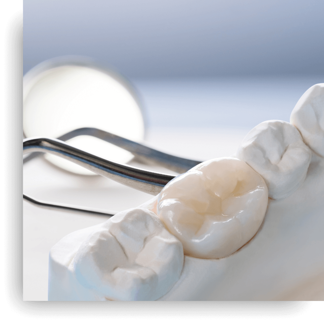 A close-up of a realistic ceramic dental crown on a white tooth model, with a metal dental mirror and pick blurred in the background.