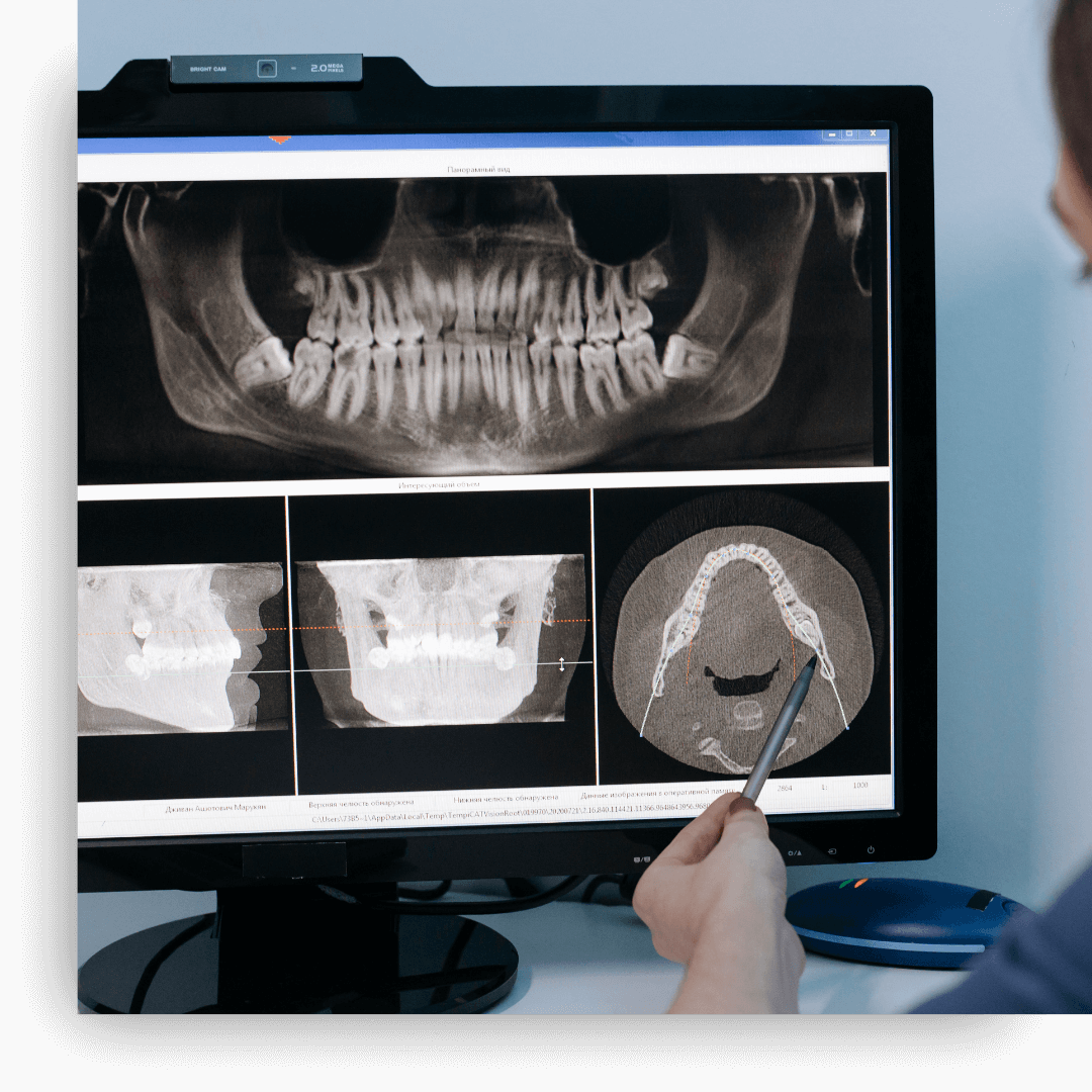 xrays of patient's mouth